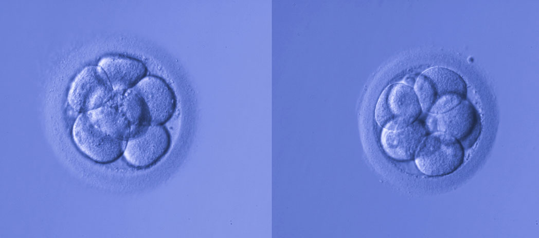 Two embryos in surrogacy